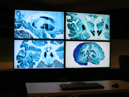 The BigBrain atlas on display (using Atelier3D software developed by the NRC) in the McConnell Brain Imaging Centre at The Neuro. / Photo courtesy of the Montreal Neurological Institute.