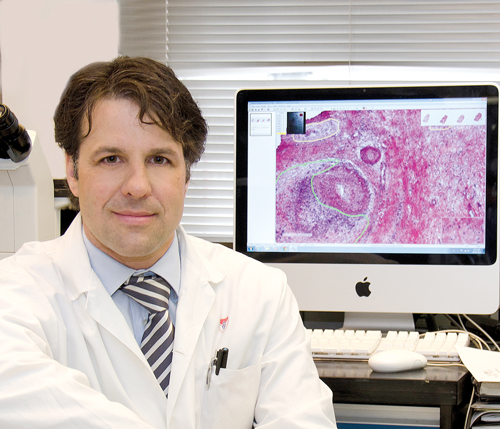Dr. Lorenzo Ferri. / Photo: Pierre Dubois, MUHC