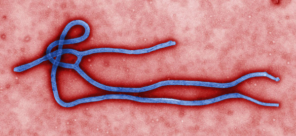 Electron micrograph of an Ebola virus virion. / Photo:  Centers for Disease Control and Prevention, Wikimedia