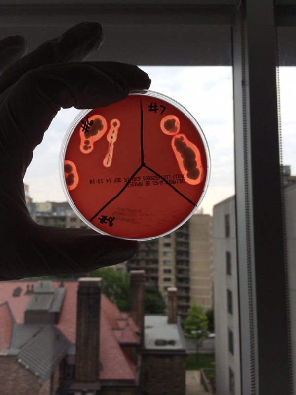 Characterization of several antibiotic-producing isolates from the soil on blood agar.