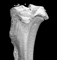   Ces vues anatomiques peuvent être fusionnées pour former une structure osseuse virtuelle en trois dimensions.