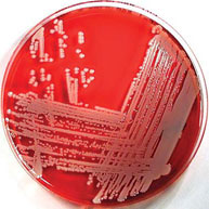 Pseudomonas aeruginosa sur un modèle gélosé Pseudomonas Hifluoro