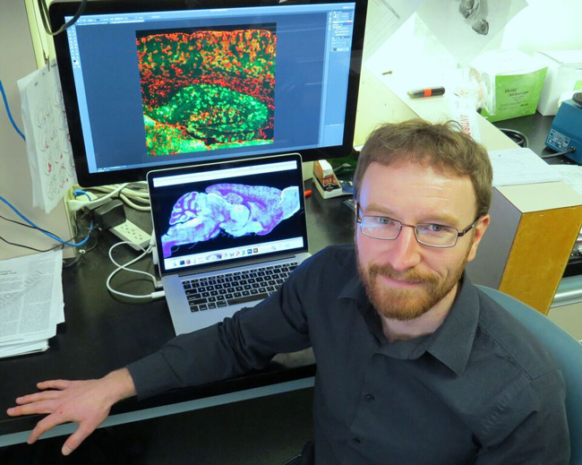 Dr. Todd Farmer, post-doctoral fellow, Centre for Research in Neuroscience, RI-MUHC